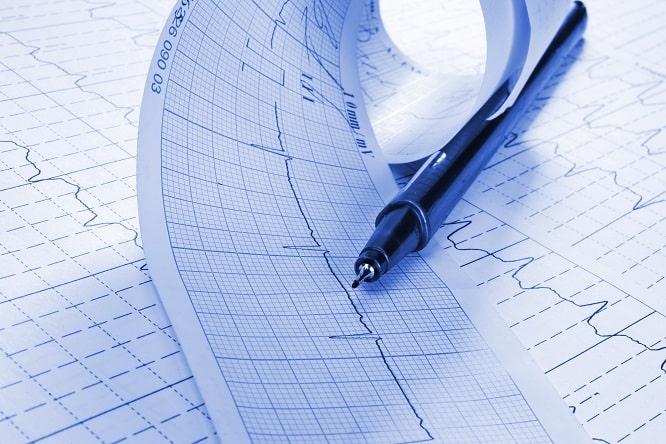 imagem de FA paroxística