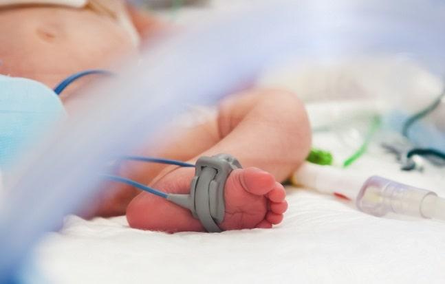 bebê recém-nascido em UTIP com hipervolemia