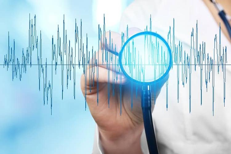 Inibidor de P2Y12 deve ser usado como pré-tratamento no infarto agudo sem supra de ST