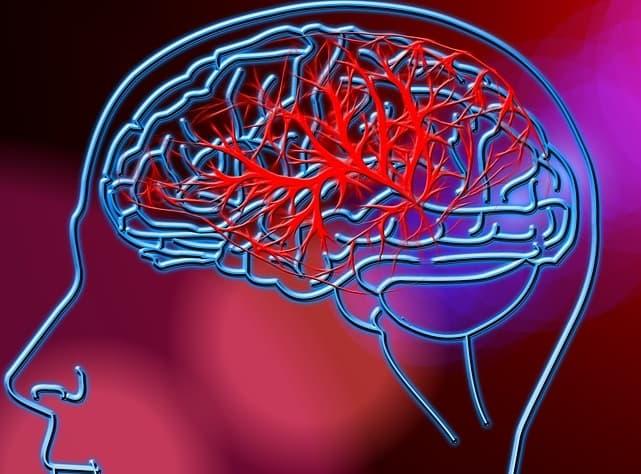 Monitorização de longo prazo para FA subclínica após AVCi