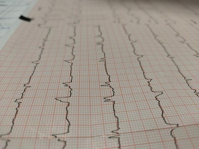 Síndromes aórticas agudas: o que precisamos saber?