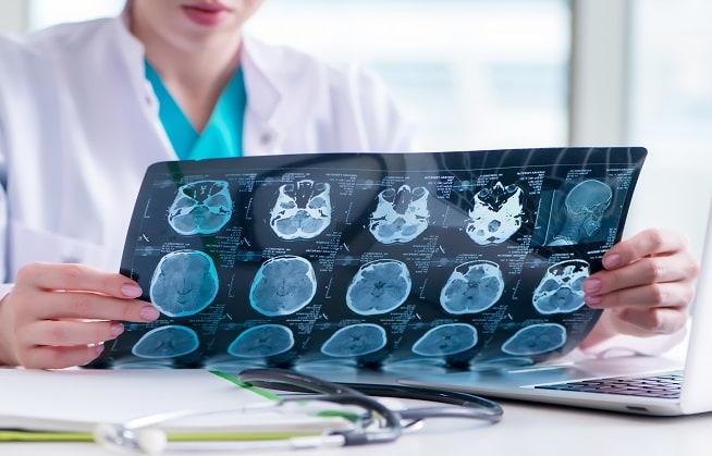 médico avaliando exame de avc isquêmico