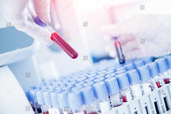 Hemocromatose: como investigar?
