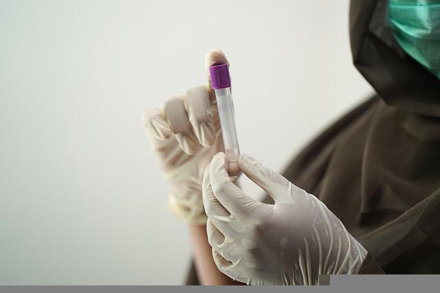 Marburg: OMS confirma surto do vírus “primo” do Ebola em Gana