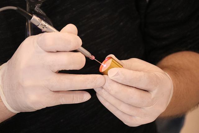 Tratamento com laser para síndrome genitourinária da menopausa (SGM)