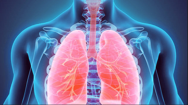 Legionella: o que precisamos saber sobre a causa do surto de pneumonia na Argentina