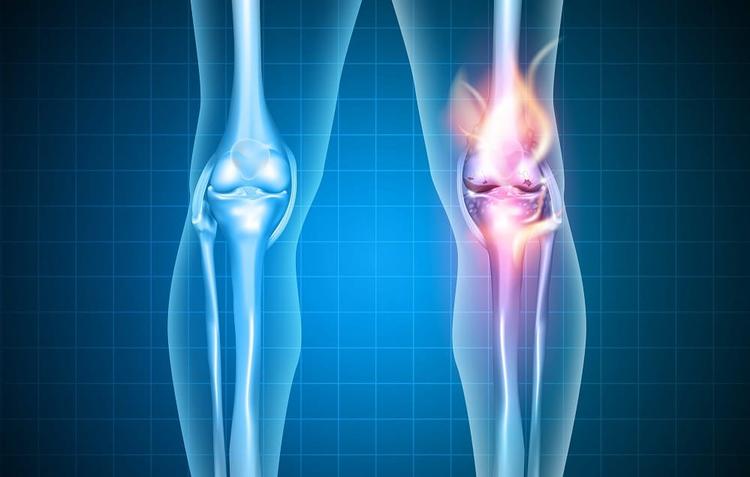 Ainda há espaço para os opioides na OA de joelhos e quadris?