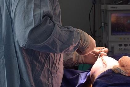 Ministério da Saúde destina mais de R$ 100 milhões para reconstrução mamária