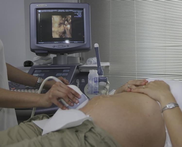 Ponto de coorte da transluscência nucal no ultrassom de primeiro trimestre