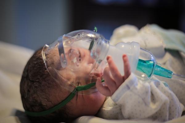 Orientação sobre uso de corticosteroides pós-natais para DPC após parto prematuro