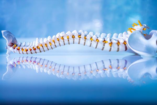 espondilite anquilosante