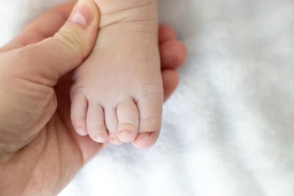 Importância do diagnóstico e tratamento precoce no pé torto congênito