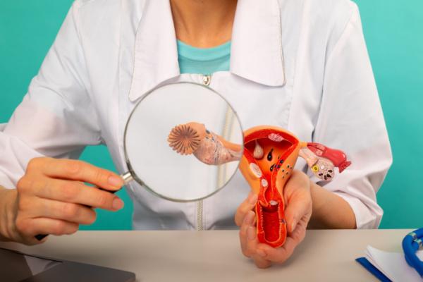 síndrome dos ovários policísticos SOP