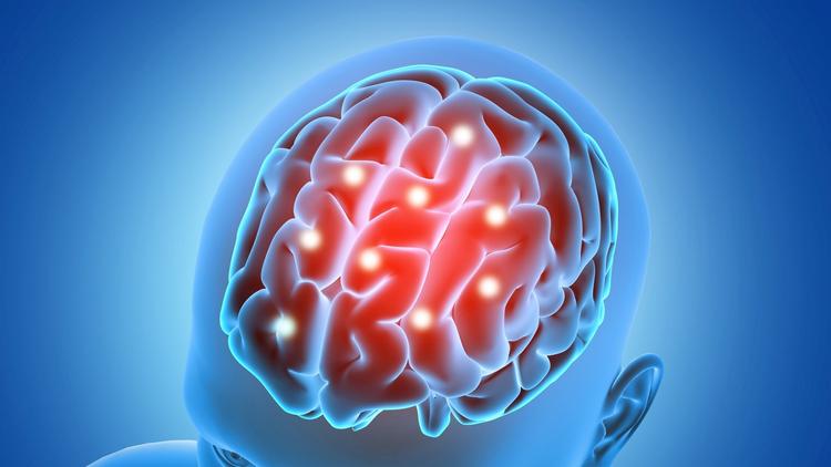 IA na identificação de FA nos pacientes com AVC de causa indeterminada