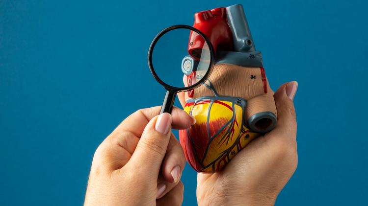 Ultrassonografia intravascular tem benefício no infarto agudo do miocárdio