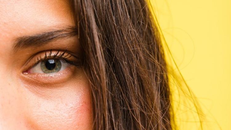 Eficácia do Lotilaner no tratamento da Blefarite por Demodex