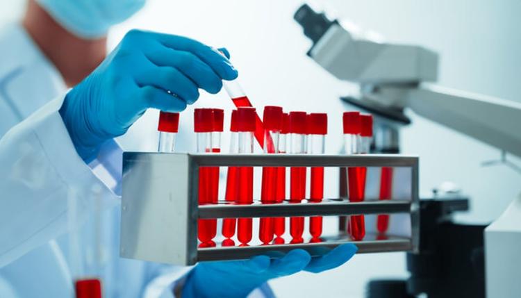 Profissional de saúde manipulando amostras de sangue indicativas de quadro de leucemia linfocítica crônica