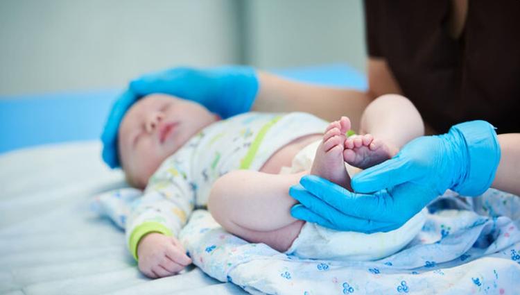 Gastrosquise: abordagem cirúrgica