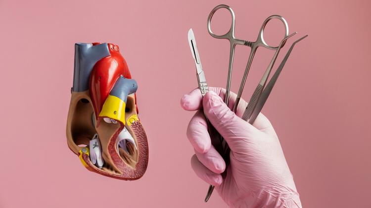 Revascularização cirúrgica nas SCA: revisão de indicações e controvérsias