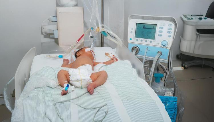 ventilação mecânica em bebê