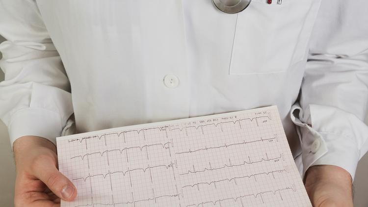 Ablação por cateter ou antiarrítmicos para pacientes com taquicardia ventricular?