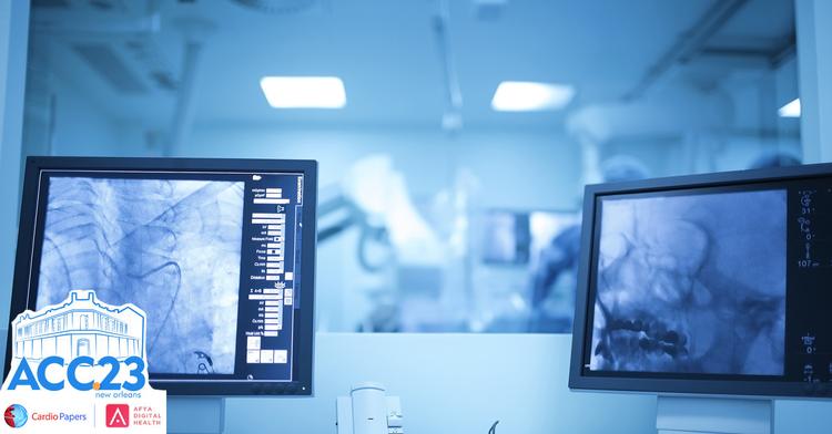 O melhor momento para revascularização completa de pacientes com SCA