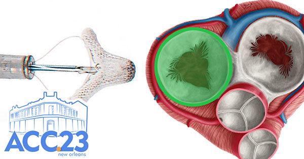 Reparo transcateter para tratar insuficiência tricúspide grave