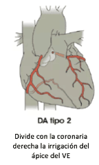 Qual a causa mais frequente de insuficiência cardíaca no Brasil?