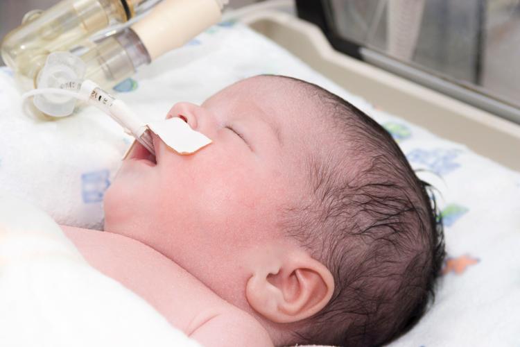 CPAP precoce na sala de parto