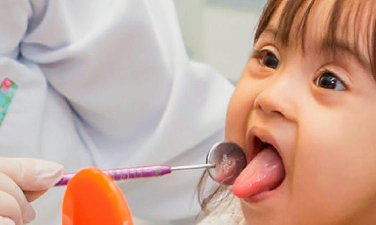 Cuidado da saúde bucal do paciente com síndrome de Down