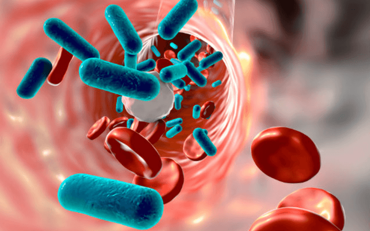 Mas afinal se tudo é sepse, quando pensar em sepse?