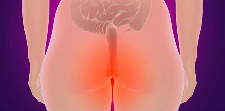 PRURIDO ANAL, QUAL VERME TRATAR?