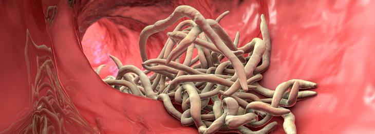 Obstrução intestinal por áscaris, devo prescrever ascaricidas?