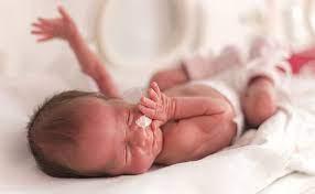 Características neonatais de algumas síndromes genéticas