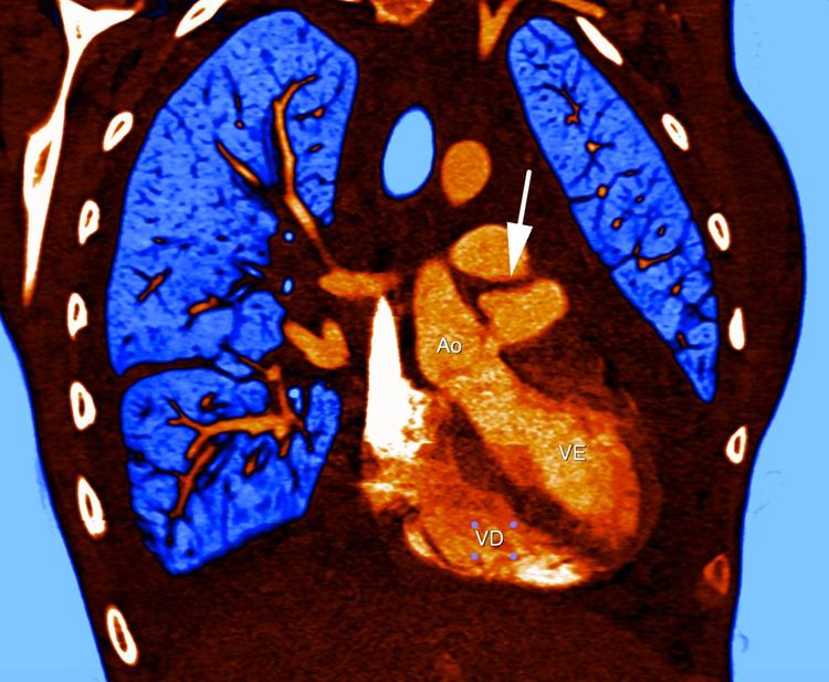 Qual é o diagnóstico desse paciente?
