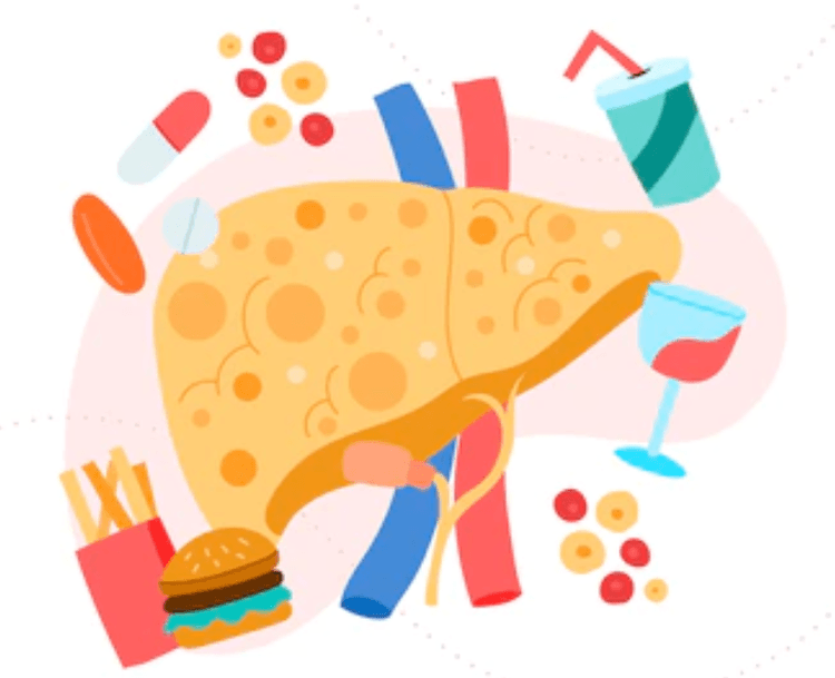 Novas nomenclaturas para doença hepática gordurosa