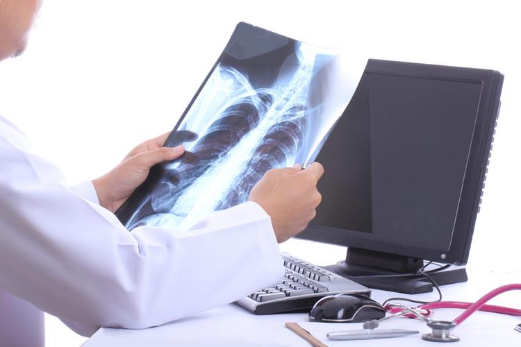 O que há de errado nesta radiografia de tórax