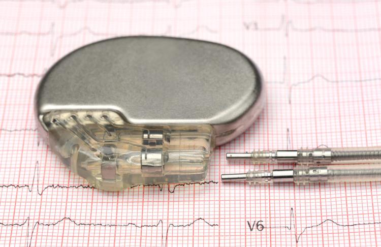 Cardiodesfibrilador Implantável Subcutâneo é uma Boa Opção?