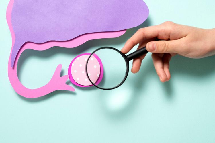 A coleta da colpocitologia oncótica