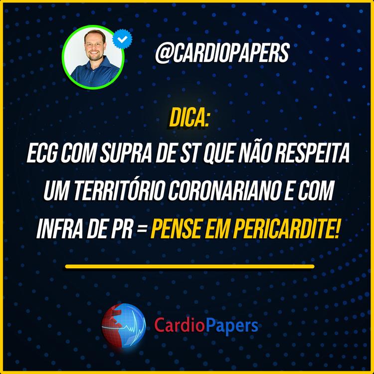 ECG com supra ST que não respeita parede e com infra PR – pense em Pericardite!