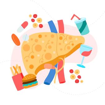 Resmetirom: um agonista de hormônio tireoidiano no tratamento da MASH.