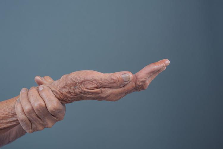 O tratamento da osteoporose com anti-reabsortivos reduz a mortalidade geral