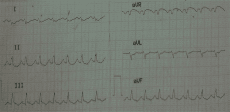 Questões em cardiologia