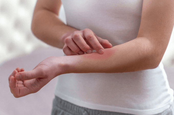 Você Sabe Quais As Diferenças Entre Os Repelentes?