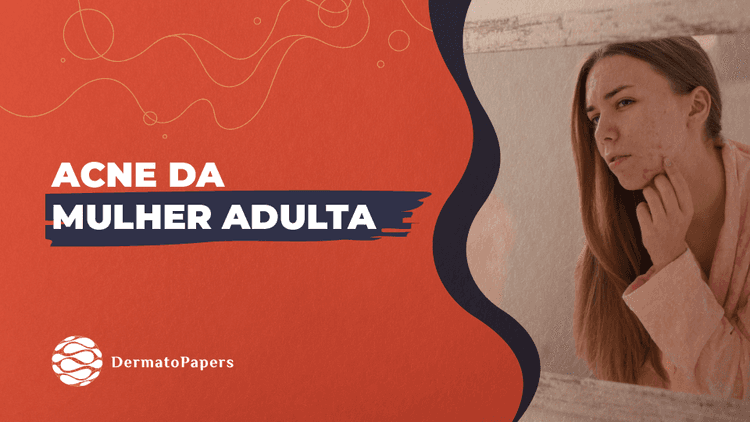 Podcast Dermatopapers: Acne Da Mulher Adulta