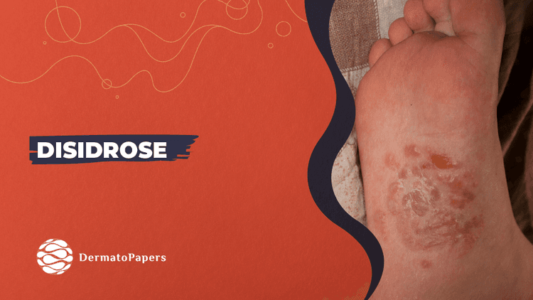 Podcast Dermatopapers: Disidrose
