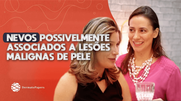Nevos Possivelmente Associados A Lesões Malignas De Pele