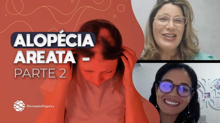 Podcast Dermatopapers: Alopécia Areata – Parte 2