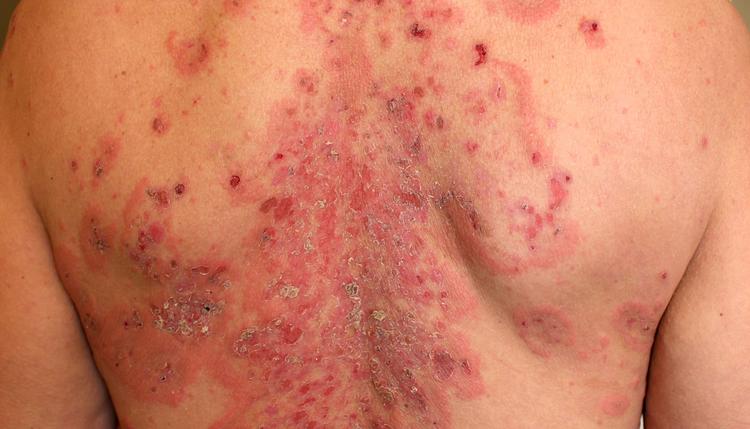 Fogo Selvagem: Você Já Ouviu Falar?