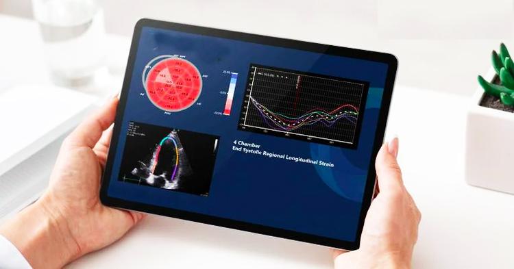 Inteligência artificial determina fração de ejeção com mais rapidez e acurácia?